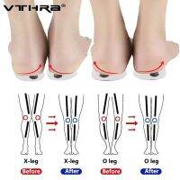 1 คู่แม่เหล็กซิลิคอน Orthopedic Insoles Foot Care เครื่องมือสำหรับผู้ชายผู้หญิง Health Care O/X ประเภทขาเข่า Varus Correction Heel Pads-Giers