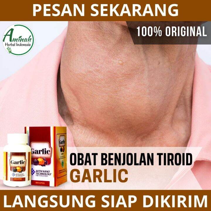 Obat Tiroid Bengkak Obat Penyakit Tiroid Obat Nodul Tiroid Obat