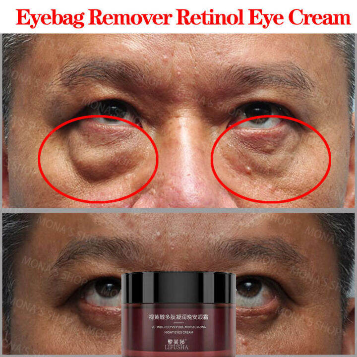 LIFUSHA Retinol eye cream eyebag remover eye cream for dark circle