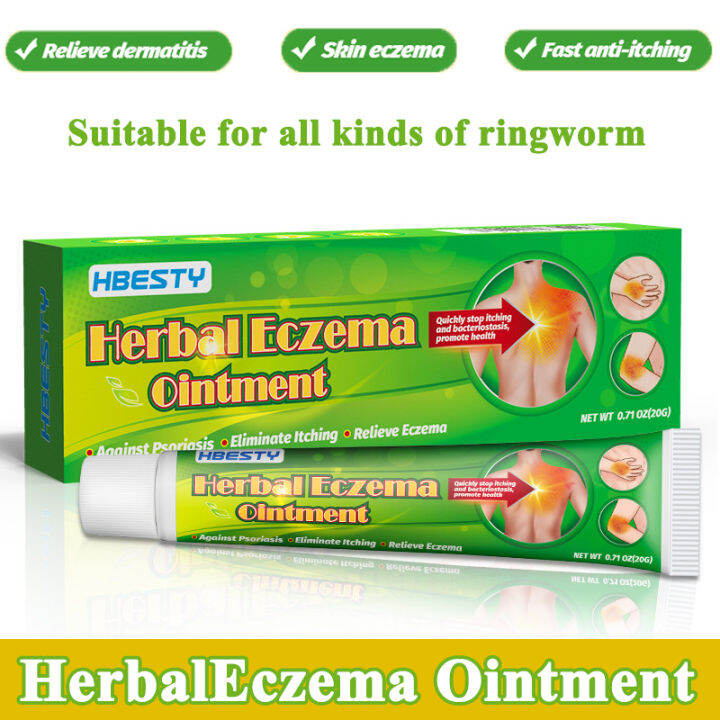 【Natural herbal ingredients】Psoriasis Cream ubat gatal gatal kulit