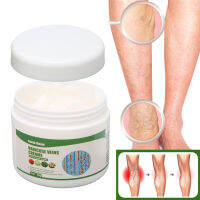 ครีมหลอดเลือดดำแมงมุม Safe Mild Varicose Vein Cream สำหรับ Home Travel สำหรับผู้ชายผู้หญิง