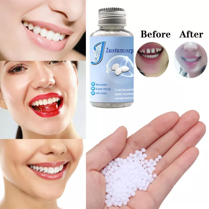 Thermal Beads, for Filling Fix the Missing and Broken Tooth or Adhesive the  Denture Fake Teeth 