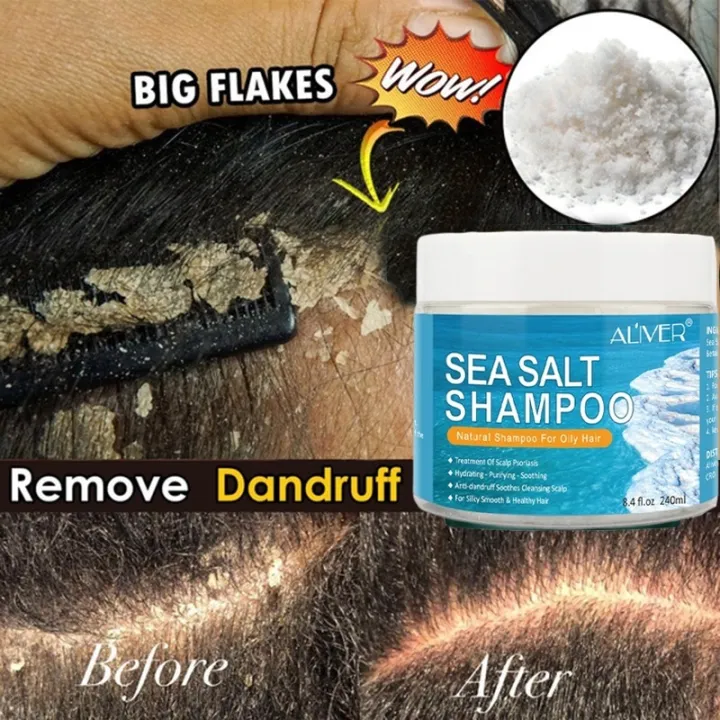 Aliver Sea Salt Shampoo Anti Dandruff Hair Treatment Shampoo For Scalp