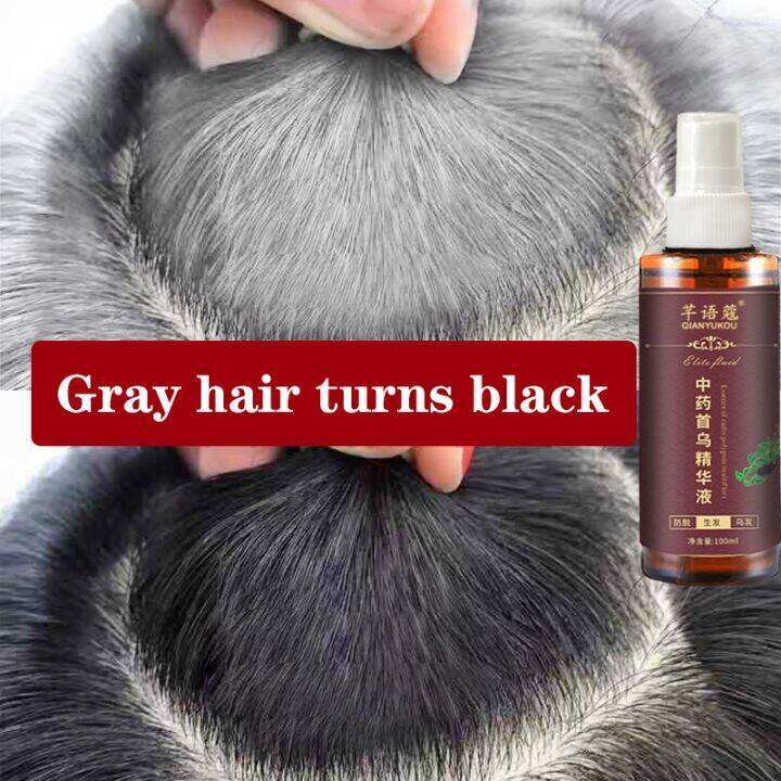 White Hair Turns Black Hair Spray Polygonum Multiflorum Herbal Extract Spray Gray Hair Repair Spray 100ml Mild Non-irritating Nourishes the Scalp Anti Hair Loss Hair Care Essence Hair Nourishing Spray for Men White Hair Turns Black Hair Spray Polygonum Multiflorum Herbal Extract Spray Gray Hair Repair Spray 100ml Mild Non-irritating Nourishes the Scalp Anti Hair Loss Hair Care Essence Hair Nourishing Spray for Men