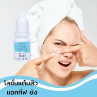 โลชั่นแต้มสิว แอคทีฟ ยัง กิฟฟารีน/ Active Young Acne Lotion Giffarine สิว แต้มสิว