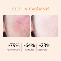 ES ✯【แท้100】 GMEELAN Blood Orange Whitening Exfoliating Gel 50g ไวท์เทนนิ่ง ทำความสะอาด เจลขัดผิวหน้าและผิวกาย ไรเซอร์ ขัดผิวหน้า ซ่อมผิวหน้า ผลัดเซลล์ผิว♀