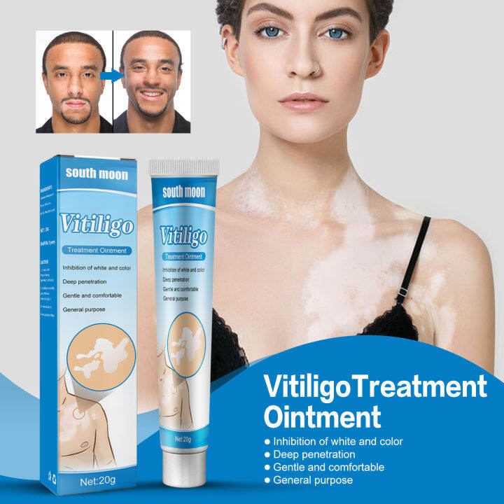 Vitiligo Removal Cream Eliminates White Patches In Vitiligo 20g Herbal Vitiligo Removal Cream Eliminates White Patches In Vitiligo 20g Herbal