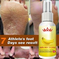 【CW】 TRSTAY Anti Fungal Infections Foot Spray for Athlete  39;s Foot Treating Beriberi Itch Beriberi Erosion Peeling Blisters Feet Spray