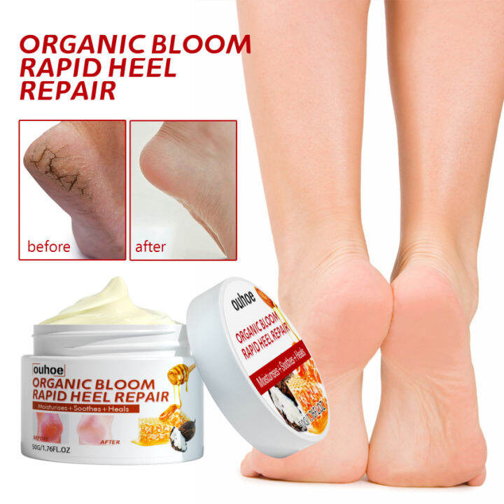 Rapid Heel Repair Cream Foot Whitening Brightening Moisturizing