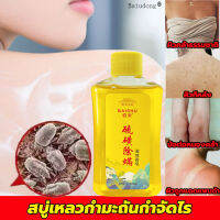 อาบน้ำกำจัดไร ! BaiDong ครีมอาบน้ำหอมๆ ลบสิวควบคุมน้ำมัน ปรับสี ขจัดกลิ่นเหงื่อ ชะล้างรูขุมขน พร้อมฟื้นบำรุงผิว สบู่เหลว สบู่อาบน้ำครีมอาบน้ำ เจลอาบน้ำ ครีมอาบน้ำเด็ก ครีมอาบน้ำตัวหอม