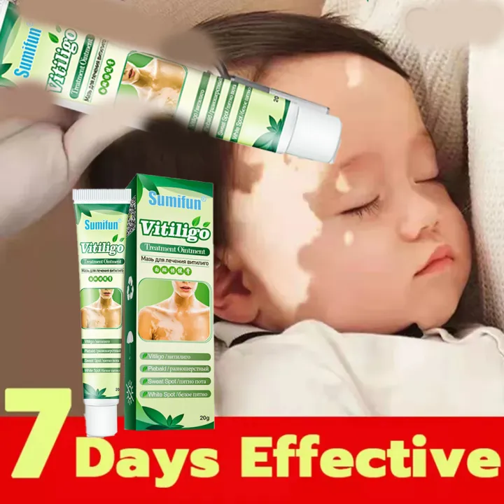 【Local delivery 】【Sumifun】 Treatment of vitiligo Chinese herbal