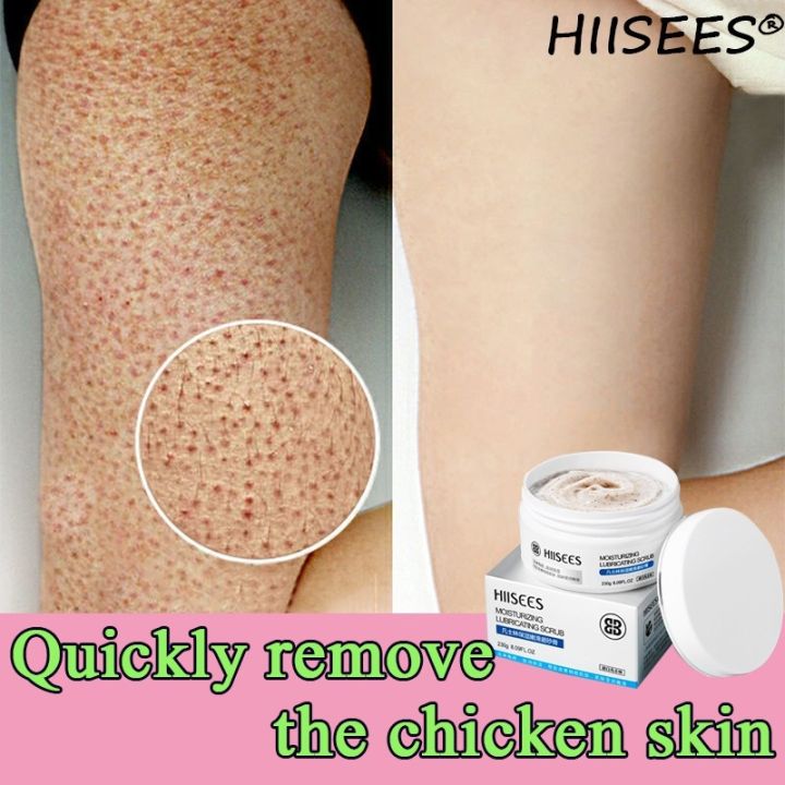 【cod】 Hiisees Body Scrub Shiny Whitening Exfoliating Bath Scrub Improve Chicken Skin Lazada Ph 