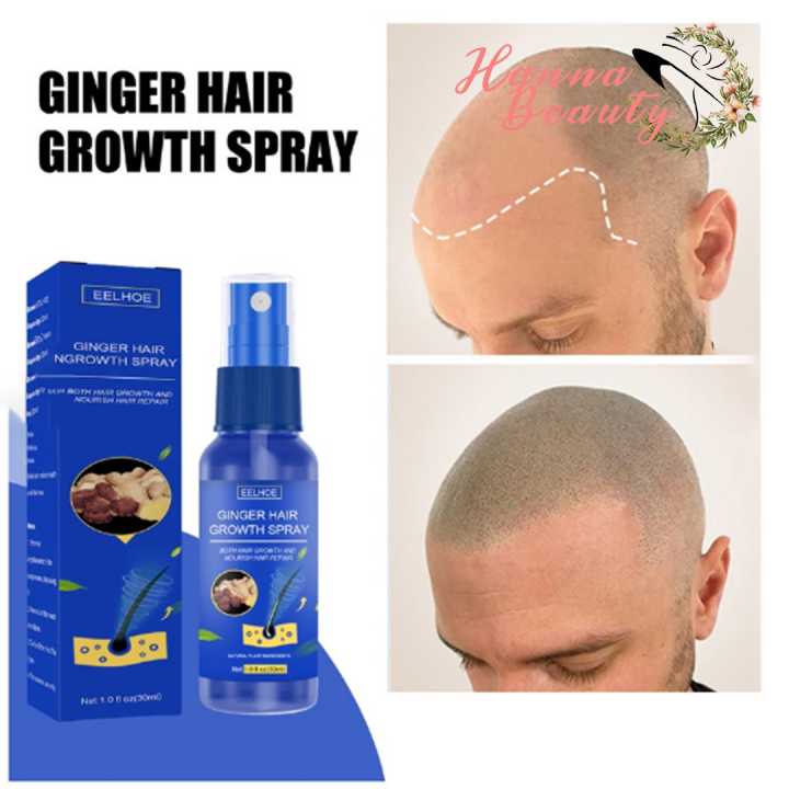 In stock NEW EELHOE Hair Growth Spray Promotes Hair Growth Hair Growth ...