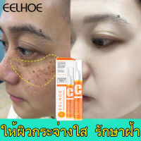 ครีมแก้ฝ้าแท้ๆ eelhoe Freckle Cream ทาฝ้าของแท้ ครีมทาฝ้าหนาๆๆ ครีม แก้ ฝ้า กระ ครีมกำจัดฝ้า vitamin c อุดมไปด้วยวิตามินรวมและอาร์บูติน ให้ความชุ่มชื้น ขาวใส ลดเลือนจุดด่างดำ