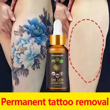 Permanent Tattoo Removal Cream Painless Maximum Strength Removal Tat Eraser  US - BAO, La Revista de Bilbao