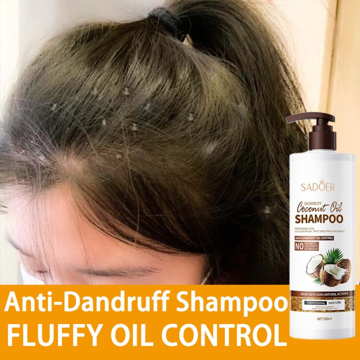 Shampoo Kelemumur Coconut Shampoo Anti Dandruff Oil Control Itchy Scalp