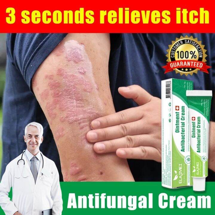 ﺴ Antifungal Cream 15g Psoriasis Eczema Ointment Treatment Cream Solution Skin Care Ointment