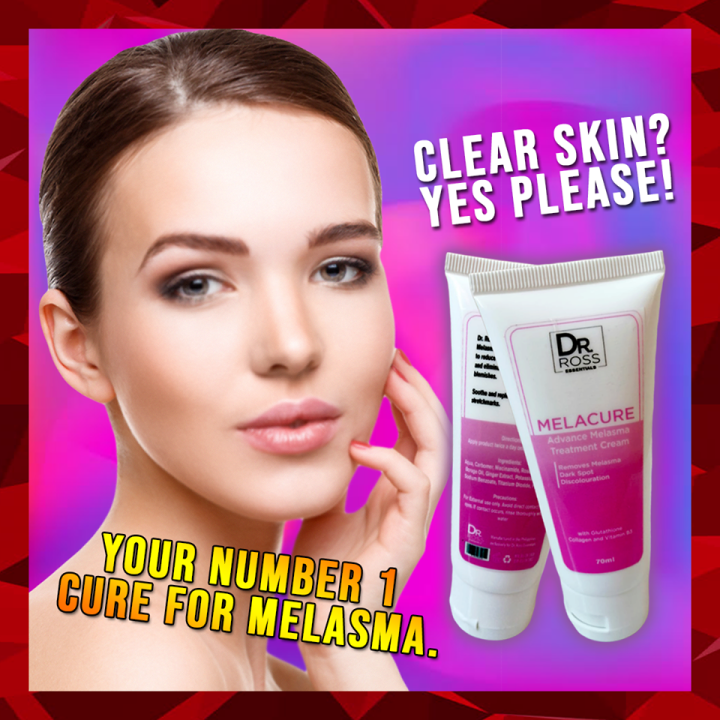 PROMO!! Melacure Advance Melasma Treatment Cream with VITAMIN B3 BEST ...