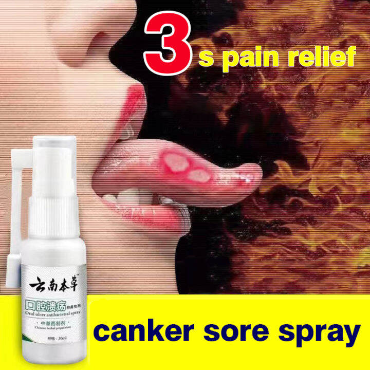 🔥3s pain relief🔥canker mouth sore solution mouth ulcer treatment spray