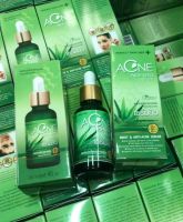 เซรั่มสิว ACNE ALOE VERA SERUM by perfecr skin lady 40 ml ( 1 ขวด)