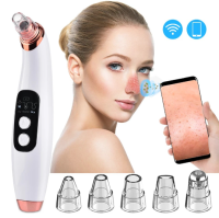 Blackhead Removal With Camera เครื่องกำจัดสิวหัวดำไฟฟ้าด้วยระบบอัจฉริยะ