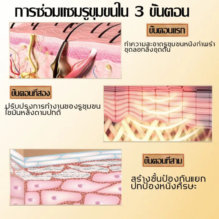 1ขวดแก้ปัญหาศีรษะหลายอย่าง-sbm-แชมพูขจัดรังแค-300ml-ยาสระผมรังแค-สำหรับคันหนังศีรษะโรคอักเสบรูขุมขนหนังศีรษะ-เชื้อราบนศีรษะ-แชมพูแก้เชื้อรา-ลดรังแคฆ่าเชื้อแก้คัน-ยาสระผมแก้เชื้อรา-ยาสระผมสมุนไพร-แชมพู