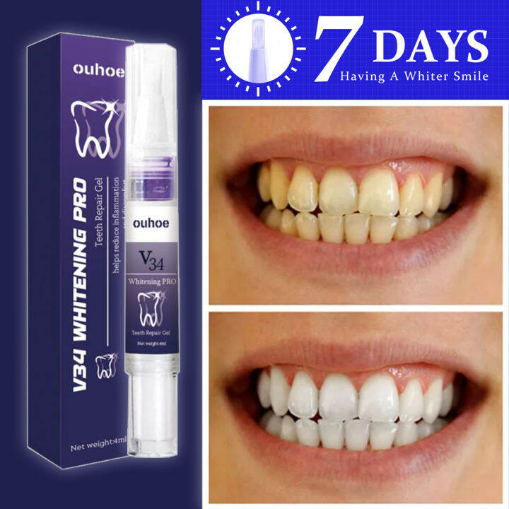 Teeth Whitening V34 Gel Pen White Teeth Cleaning Serum Oral Care 4ML