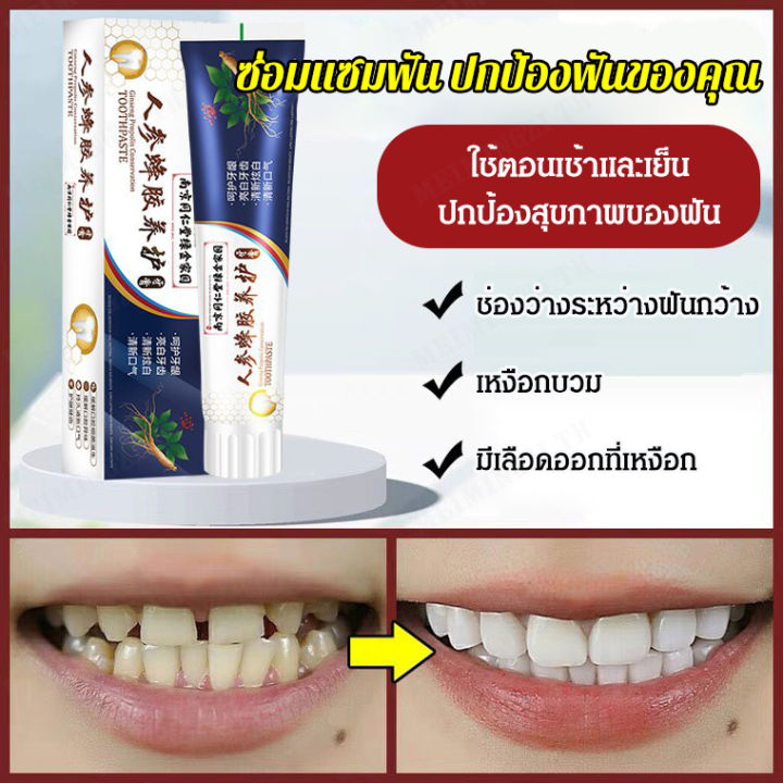 meimingzi-1-2-ชิ้น-ยาสีฟันรักษาอาการฟันหลวมนำเข้าจากญี่ปุ่น