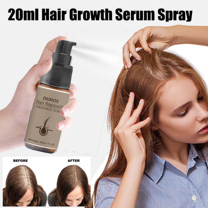 Powerful Hair Growth Serum Spray Ginger Anti Hair Loss Treatment Products Repair Nourish Hair 0658