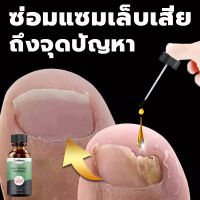 ?TanKsen30ml บอกลาเชื้อราเล็บ ยาเชื้อราเล็บ ยารักษาเล็บ ครีมบำรุงเล็บ ยารักษาเชื้อราที่เล็บ ซ่อมแซมเล็บเสีย ยาเซรั่มรักษาเล็บขบ กำจัดเล็บเสีย(เซรั่มบำรุงเล็บ เซรั่มซ่อมแซมเล็บ เชื้อราเล็บมือ น้ำยารักษาเล็บ เซรั่มเล็บ บำรุงเล็บน้ำมันบำรุงเล็บ)Fungal Nail