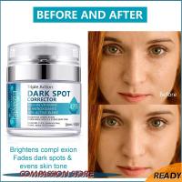 Dark Spot Remover for Face &amp; Body, Dark Spot Corrector for Women other travel accessories