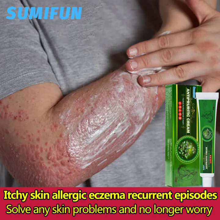 SUMIFUN anti bacterial cream 20g psoriasis eczema and eczema cream safe ...