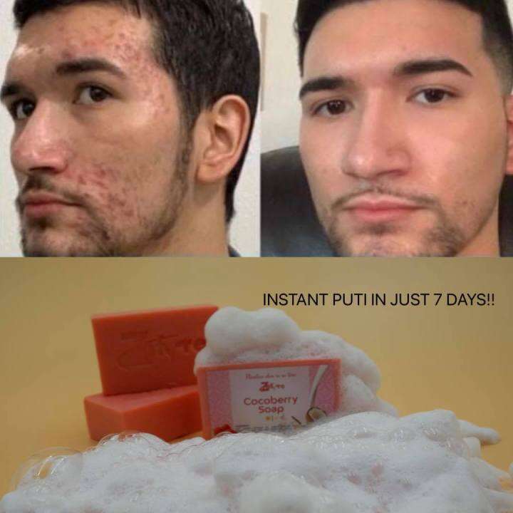 ZAFYRE COCOBERRY BLEACH SOAP SKIN CARE 100 LEGIT NA SABON