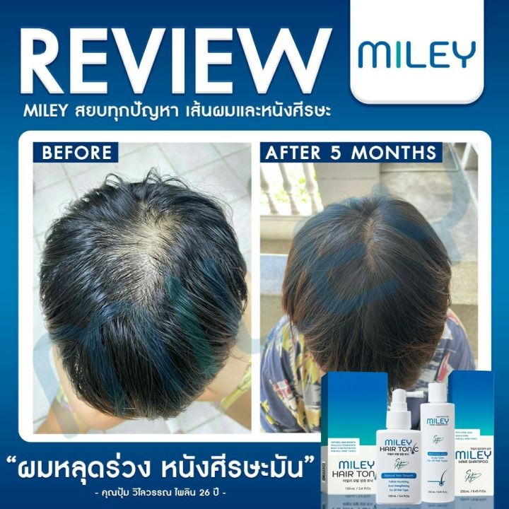 โปร-2แถม2-แชมพูลดผมร่วง-มิลเล่-แฮร์-แชมพู-miley-hair-tonic-miley-hair-shampoo-ผลิตภัณฑ์ดูแลเส้นผม-จากเกาหลี