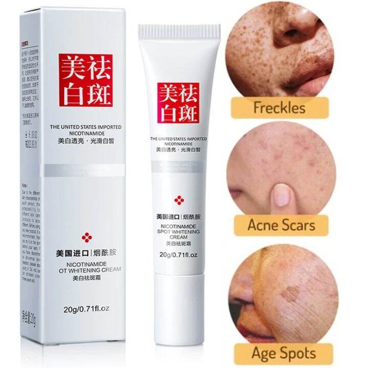Freckle Removal Cream Whitening Anti Melasma Removal and Dark Spots