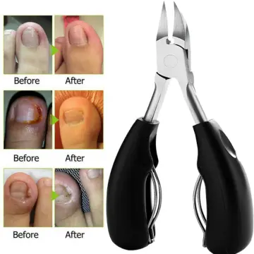 Heavy Duty Toenail Clippers for Thick Ingrown Toe Nails Precision Nail  Scissors