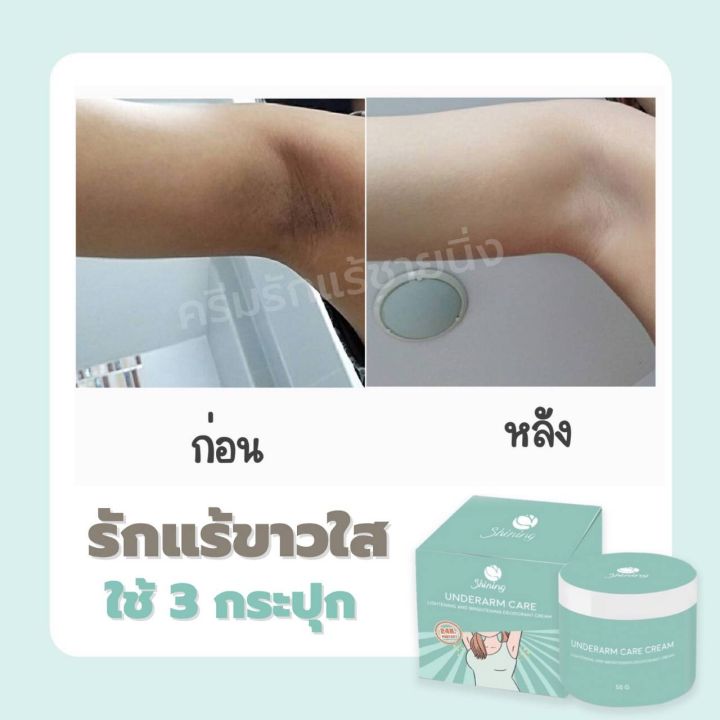 underarm-care-cream-ของแท้-ครีมรักแร้ขาว-shining-ครีมรักแร้ชายนิ่ง-ขนาด-50-กรัม-รักแร้ขาว-ลดตุ่มหยังไก่-บอกลาผิวคล้ำเสีย-ทั่วเรือนร่าง