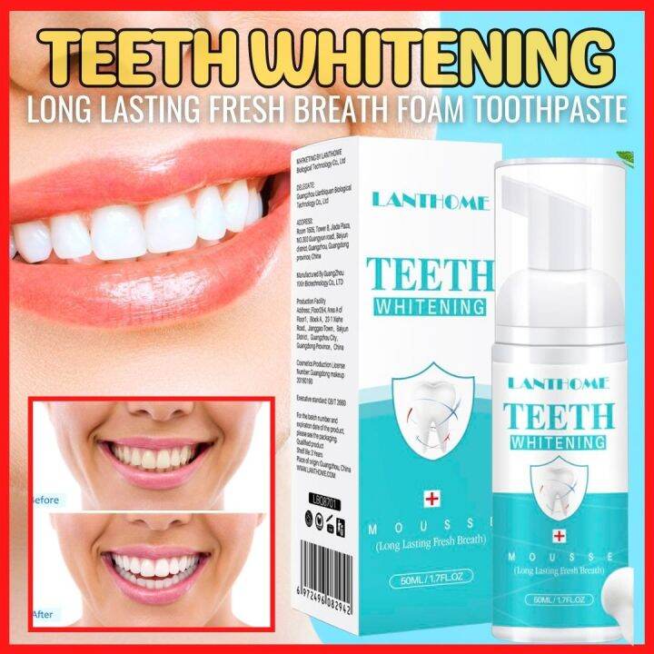 TRENDZ Teeth Whitening Teeth Cleaning Mousse White Teeth Oral Hygiene ...