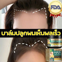 [ สินค้าส่งจากไทย ] ครีมปลูกผม เซรั่มปลูกผมขิง ของแท้ 100% เซรั่มสมุนไพร น้ำยาปลูกผม น้ำยาเร่งผมยาว  สารสกัดจากขิง น้ำยาปลูกผม เซรั่มปลูกผม ซ่อมแซมผมเสีย เร่งผมยาว ป้องกันผมร่วง Ginger Hair Essence