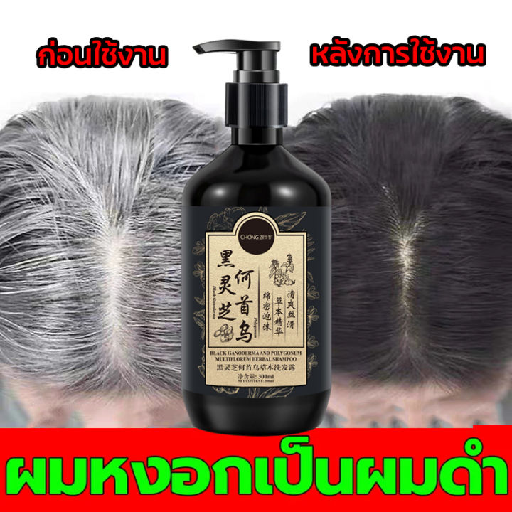 ให้ผมเปลี่ยนเป็นสีดำจากราก-แชมพูเหอโส่วอู-ยาสระผมดำ-300ml-ไม่ต้องย้อมผมแค่สระผมแล้วผมผมหงอกจะค่อยๆหายไป-แชมพูปิดผมหงอก-แชมพูผมดำ-ปิดผมขาว-แชมพูสมุนไพร-แชมพูแก้ผมหงอก-แชมพูสระผมดำ-แชมพูปิดหงอกแชมพูปิดผ