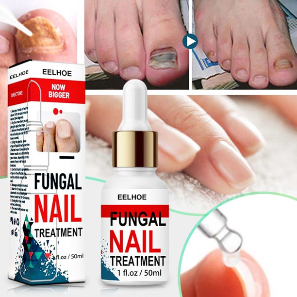 Original and Effective Eelhoe Fungal Nail Treatment Essence Serum Anti ...