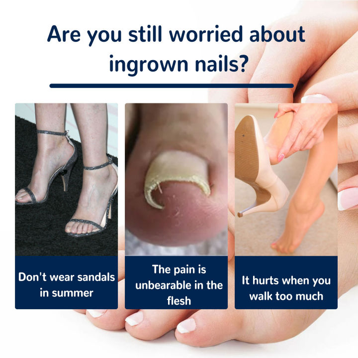 zx-beauty-shop-toe-nail-correction-patch-foot-care-pedicure-tool-fixer-ingrown-toenail-corrector-sticker-paronychia-recover-toenail-elastic-patch-corrector-anti-roll-nail-free-glue-toe-inlay-nail-corr