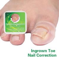 2PC/Box Ingrown Toe Nail Correction Sticker Patch Paronychia Invisible Elastic Nail Pedicure Orthotics Patch Foot Care Treatment