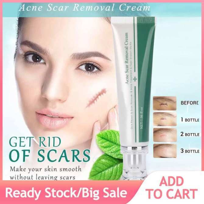 [100% Original] BREYLEE 30g Scar Acne Mark Removal Cream Skin Repair ...