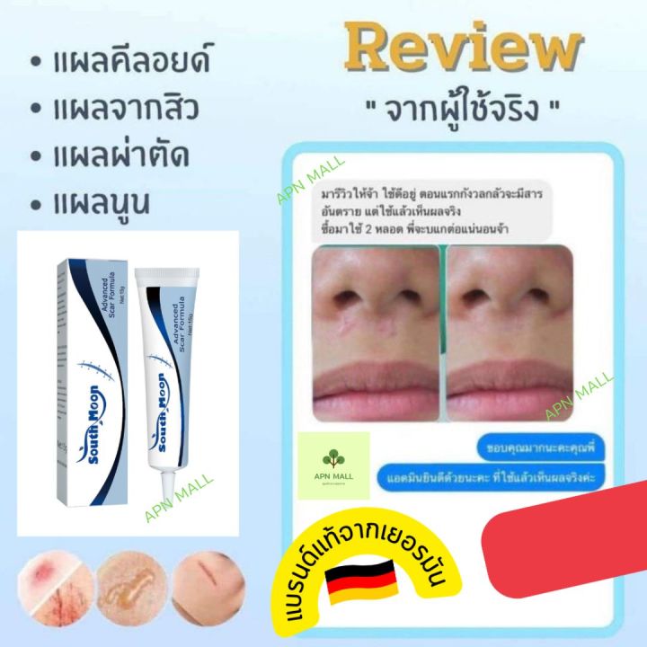 ของแท้จากเยอรมัน-พร้อมส่ง-ครีมลดรอยแผลเป็น-ลดรอยแผลเป็น-รอยสิว-ลบรอยแผลเป็น-สำหรับรอยสิว-แผลเผาไหม้-แผลเป็นจากการผ่าตัด