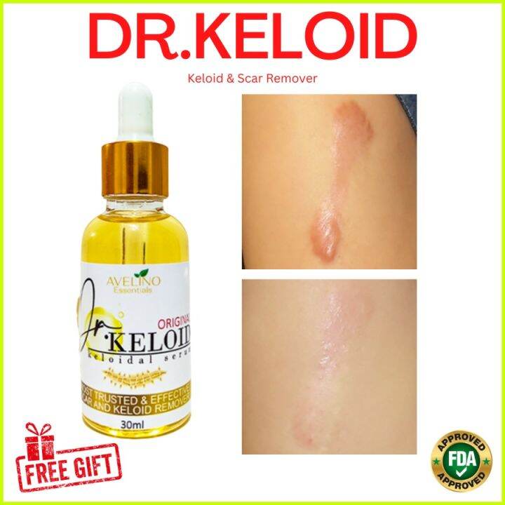 ♦DR.KELOID Original Keloid Scar Remover 30ml ( old scar keloid remover
