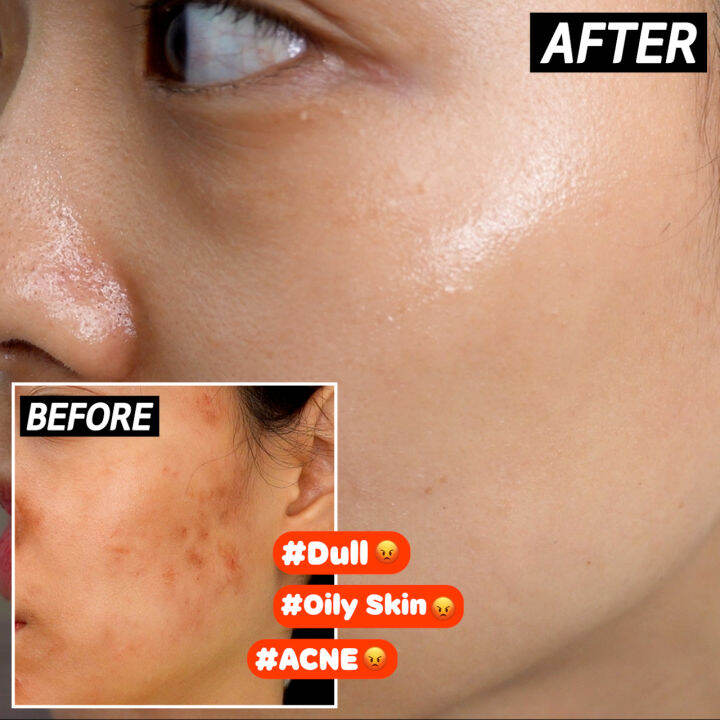 [Dirt phobia Official] Effectem D Solution Ampoule Serum 100ml, HSA certified, non