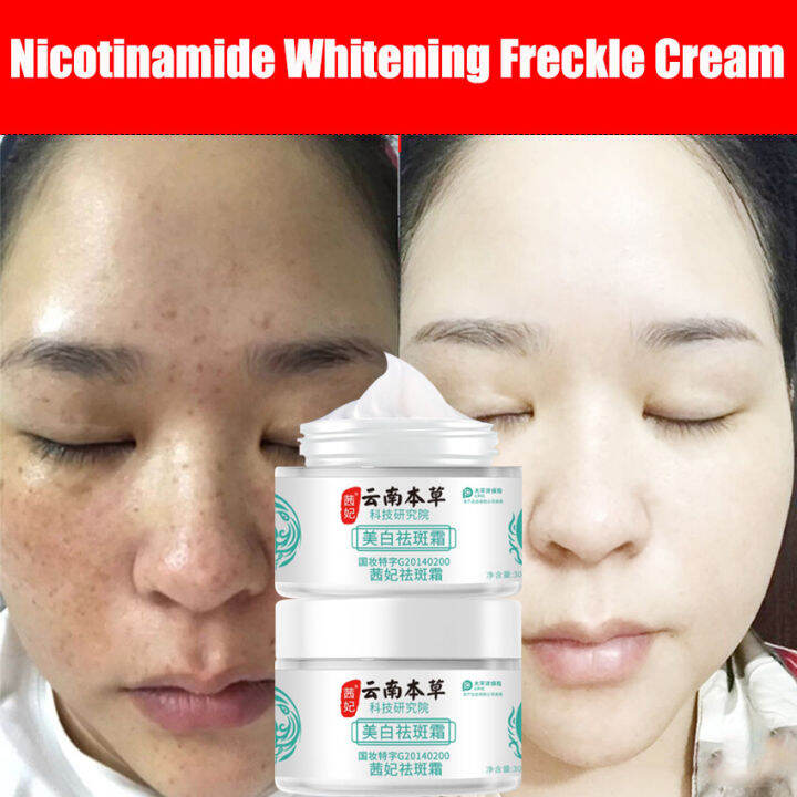 Japanese Melasma Cream Yunnan Herbal Whitening Freckle Cream Japanese Melasma Cream Original