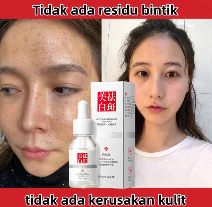 Cindynal Effective Freckle Remove Dark Spots Serum Glowing Pencerah ...
