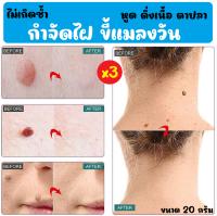 (3 หลอด) กำจัดไฝ ขี้แมลงวัน กำจัดถึงราก ไม่เกิดซ้ำ ขนาด 20g.